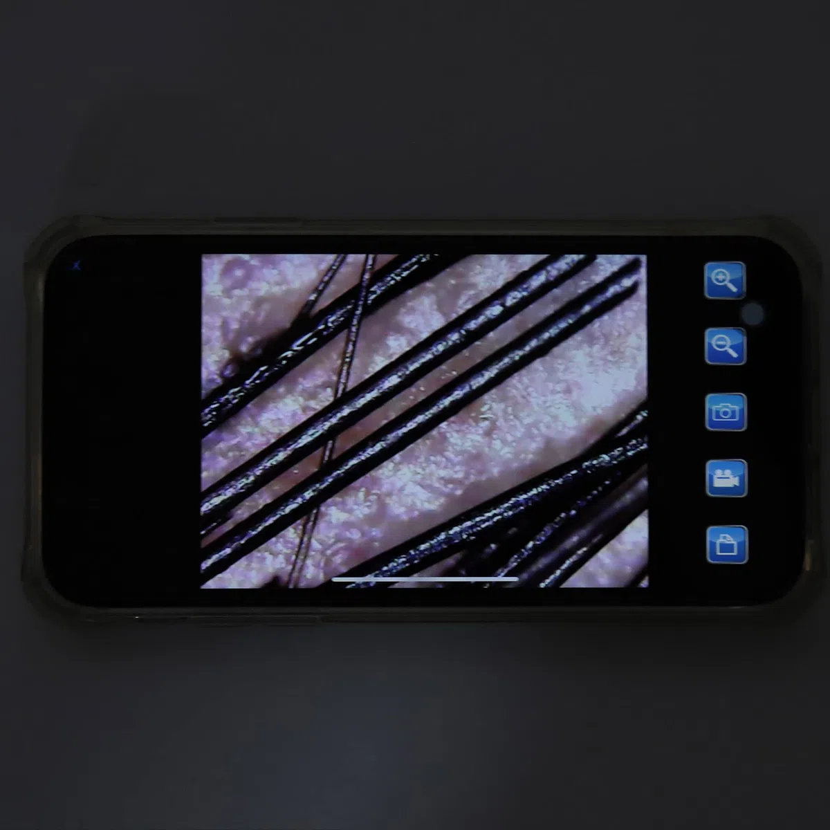 Detector de Vello de la Piel, Microscopio Digital Inalámbrico WiFi Analizador Folículos Pilosos el Diagnóstico de la Piel, Detector Manual de Vello del Cuero Cabelludo, Microscopio Belleza de 800X